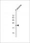 TIMP3 Antibody (C-term)