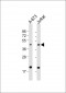 IL11RA Antibody (C-Term)