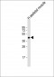 IL11RA Antibody (C-term)