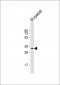 RLBP1 Antibody (C-term)