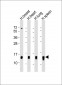 S100A9 Antibody (Center)