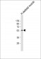 CHRM4 Antibody (C-Term)