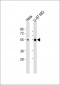 NXF3 Antibody (N-Term)