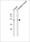 TRIM55 Antibody (Center)