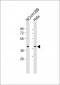 TWF1 Antibody (Center)