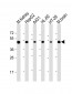 NDUFV1 Antibody (Center)