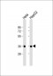 AKR1C2 Antibody