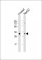 ATP5C1 Antibody