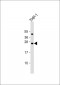 HMGB2 Antibody