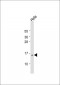 CD225 Antibody