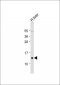 MRPL41 Antibody