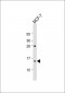 RPS12 Antibody