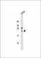 SAR1B Antibody