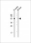 LAG3 Antibody (Center)