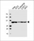 LDHA Antibody (Center)