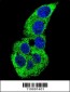 ACTG1 Antibody (Center)