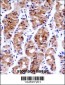 GTF2E1 Antibody (N-term)