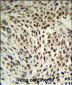 SNRPD3 Antibody (C-term)