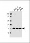 SNRPD3 Antibody (C-term)