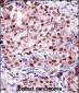 TERF2IP Antibody (C-term)