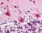FANCA Antibody (aa995-1009)