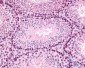 GLI2 Antibody (Internal)