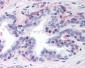 PPARG / PPAR Gamma Antibody (N-Terminus)