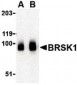 KIAA1811 / BRSK1 Antibody (C-Terminus)