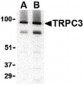 TRPC3 Antibody (C-Terminus)