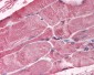 BMI1 / PCGF4 Antibody (aa252-264)