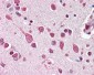 CUL7 Antibody (C-Terminus)