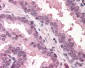 RAD23A / HHR23A Antibody (aa122-135)