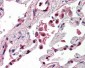 TLR8 Antibody (Internal)