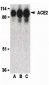 ACE2 / ACE-2 Antibody (Internal)