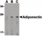 Adiponectin Antibody (C-Terminus)