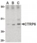 C1QTNF6 / CTRP6 Antibody (Internal)