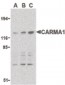 CARMA1 / CARD11 Antibody (C-Terminus)