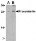 CBLN1 / Cerebellin 1 Antibody