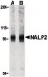 NLRP2 / NALP2 Antibody (C-Terminus)