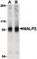 NLRP2 / NALP2 Antibody (C-Terminus)
