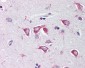 PCBP4 Antibody (C-Terminus)