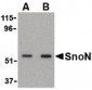 SKIL / SNO / SnoN Antibody (N-Terminus)