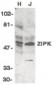 DAPK3 / ZIP Kinase Antibody (Internal)