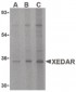 EDA2R / XEDAR Antibody