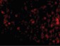 EIF2AK2 / PKR Antibody (C-Terminus)