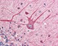 EIF2AK2 / PKR Antibody (C-Terminus)