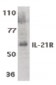 IL21 Receptor Antibody (aa97-111)