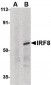 ICSBP / IRF8 Antibody (C-Terminus)