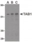TAB1 Antibody