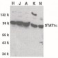 STAT1 Antibody (C-Terminus)